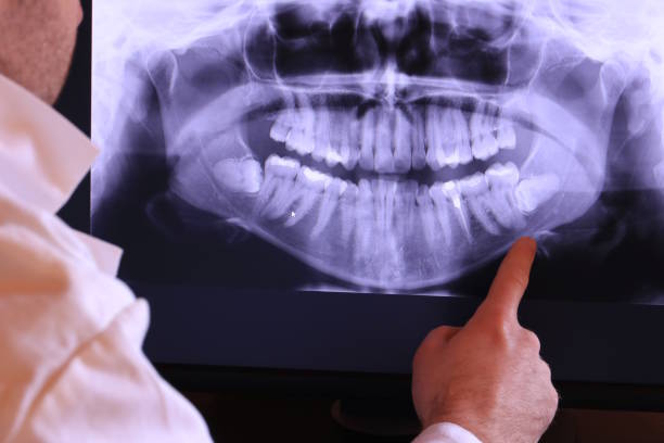 Best Broken Tooth Emergency  in Steele Creek, AK